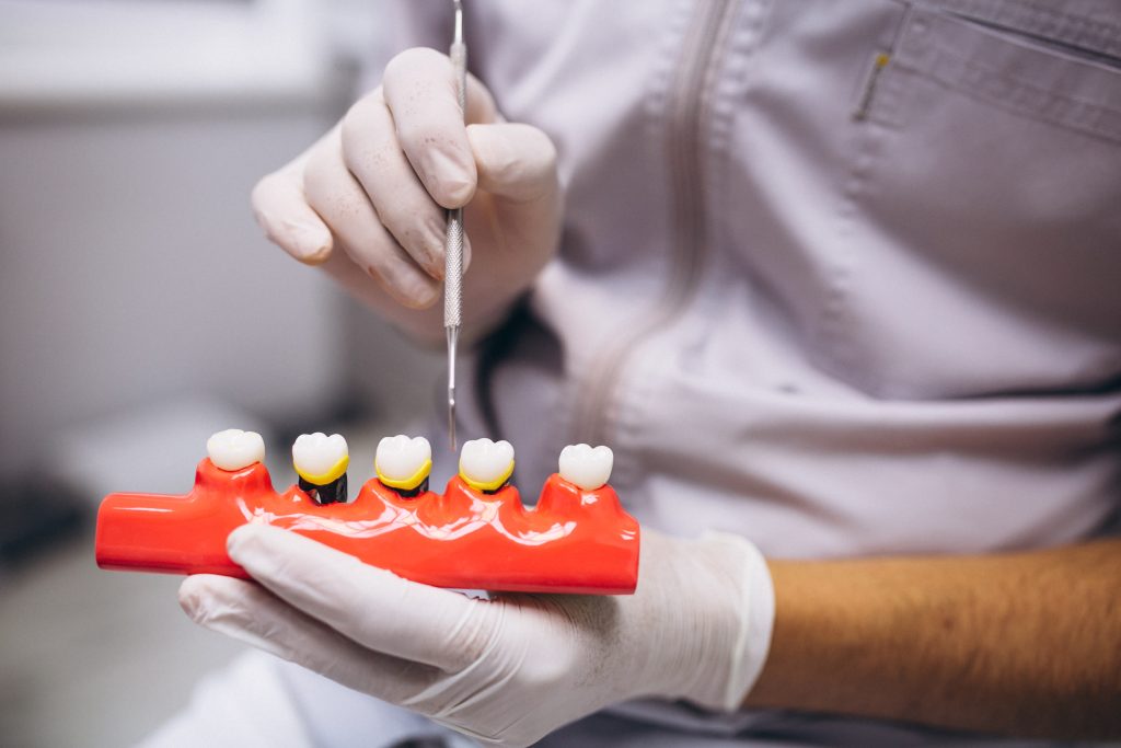 Clinica Dentale Roma: Trattamenti Avanzati per la Salute del Tuo Sorriso